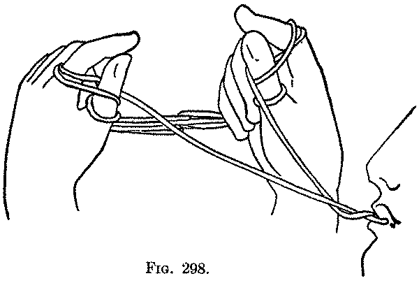 Fig. 298