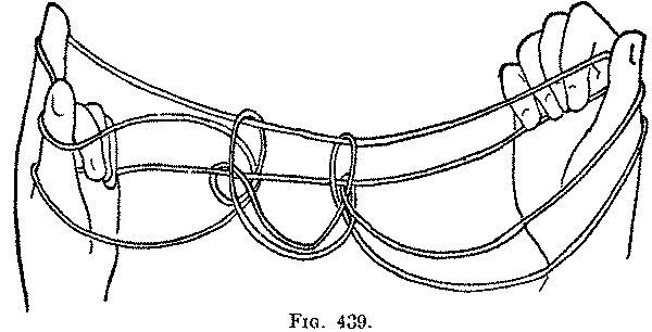 Fig. 439