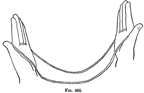 Fig. 465