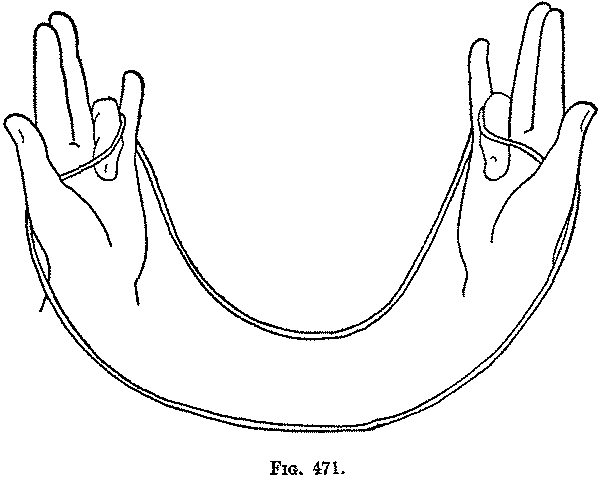 Fig. 471