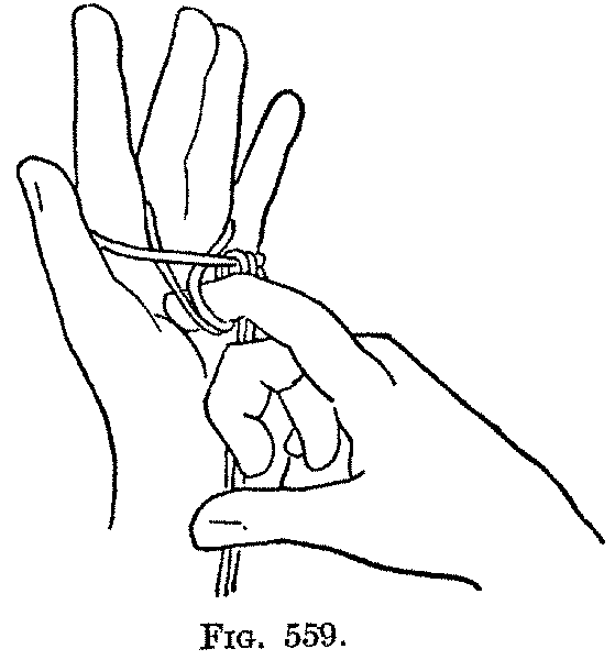 Fig. 559