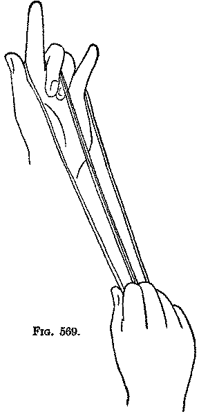 Fig. 569