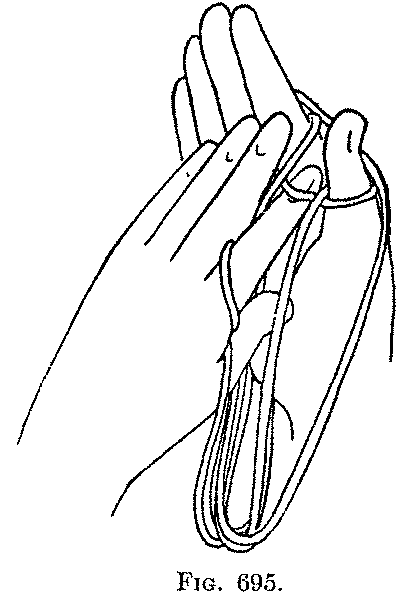 Fig. 695